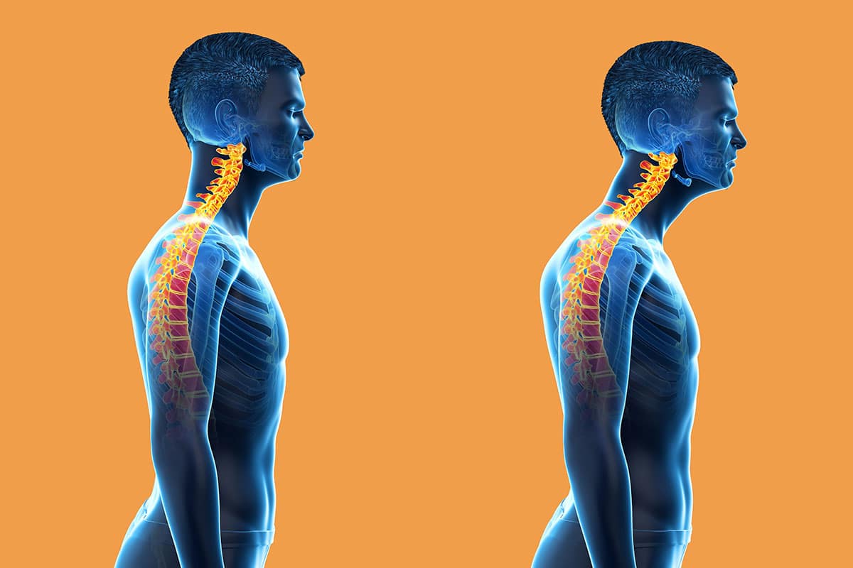 Chiropractic-patients-and-nerd-neck