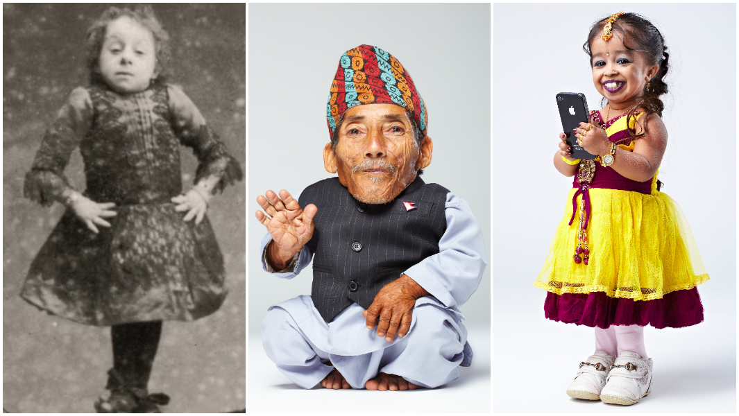 Top 10 Shortest People In The World